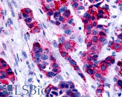 PathPlus™ Polyclonal Rabbit anti-Human GPER1 / GPR30 Antibody (Cytoplasmic Domain, IHC, IF, WB)