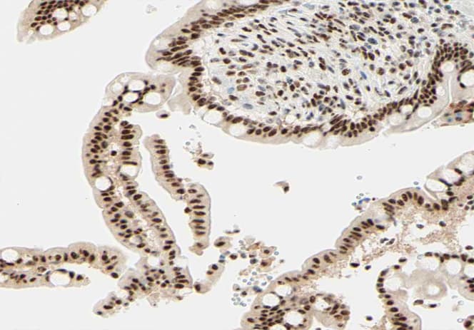 N-CoR / NCOR1 Antibody