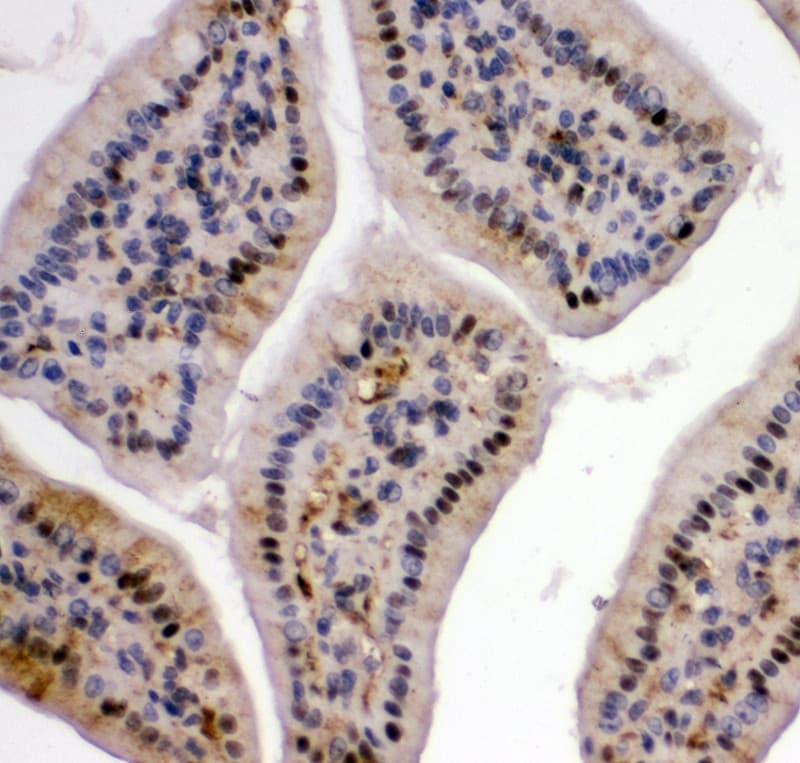 Polyclonal Rabbit anti-Human VCP Antibody (aa749-766, IHC, WB)