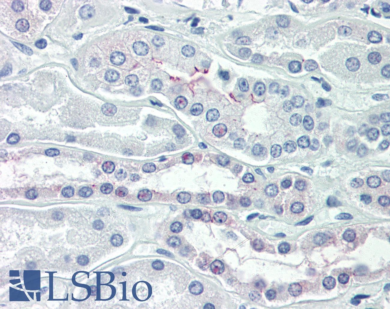 IHC-plus™ Monoclonal Mouse anti-Human OCLN / Occludin Antibody (clone OC-3F10, C-Terminus, IHC, IF, WB)