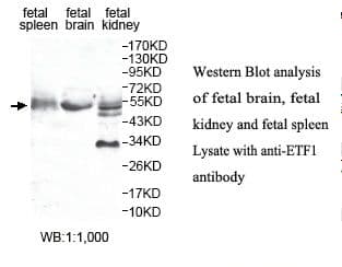 ETF1 / ERF1 Antibody (aa1-171)