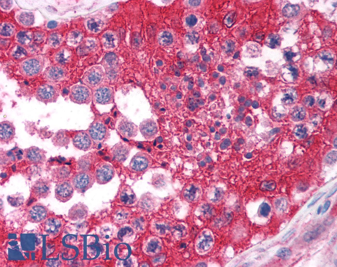 Polyclonal Rabbit anti-Human FOXE3 Antibody (aa235-284, IHC, WB)