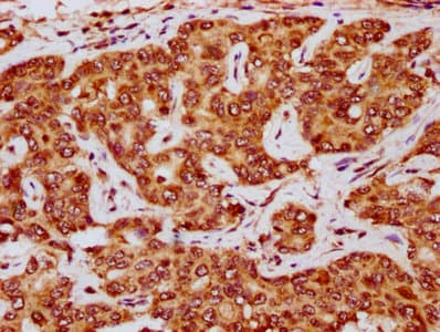 E2F5 Antibody