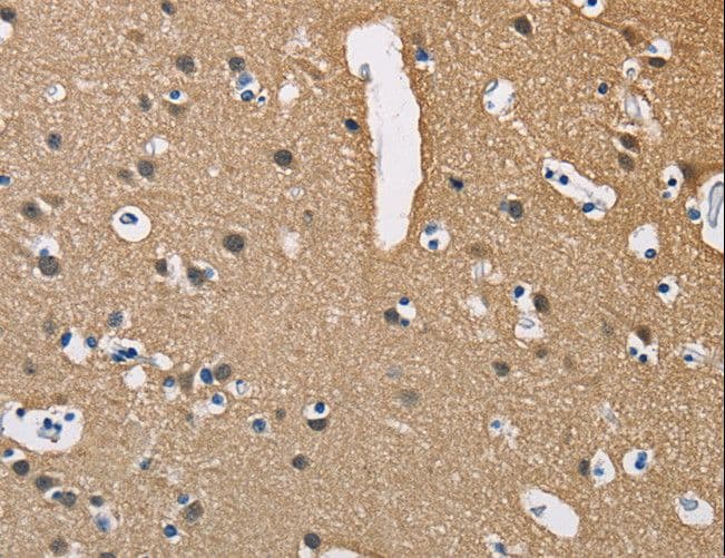 PPP3CA / CCN1 / Calcineurin A Antibody