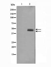 MAPK3 / ERK1 Antibody (phospho-Tyr204)
