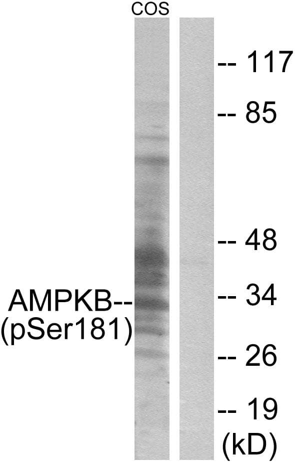PRKAB1 / AMPK Beta 1 Antibody (phospho-Ser181)