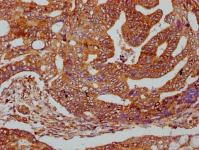 Polyclonal Rabbit anti-Human C1orf27 Antibody (IHC, IF, WB)