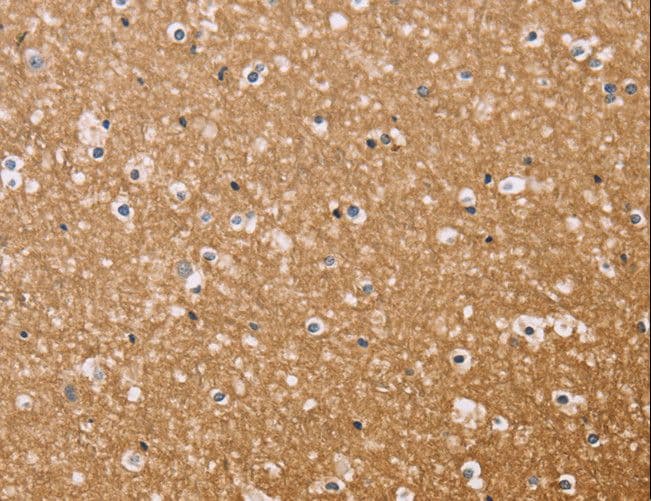 Osteocalcin Antibody