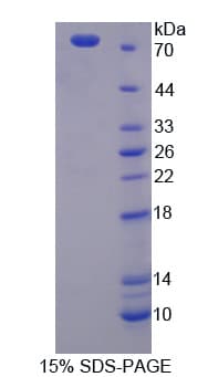 Human PSMD6 Protein (Recombinant His-GST)