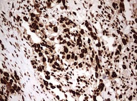 Monoclonal Mouse anti-Human HNRPM / HNRNPM Antibody (clone OTI3F3, aa1-261, IHC, WB)