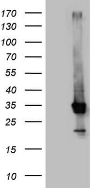 CRP / C-Reactive Protein Antibody (clone OTI4B4, Carrier-free)