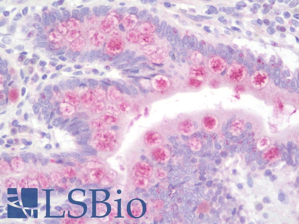 IHC-plus™ Polyclonal Rabbit anti-Human AGO1 / EIF2C Antibody (aa27-56, IHC, WB)