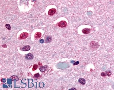 PathPlus™ Nor-1 / NR4A3 Antibody (C-Terminus)