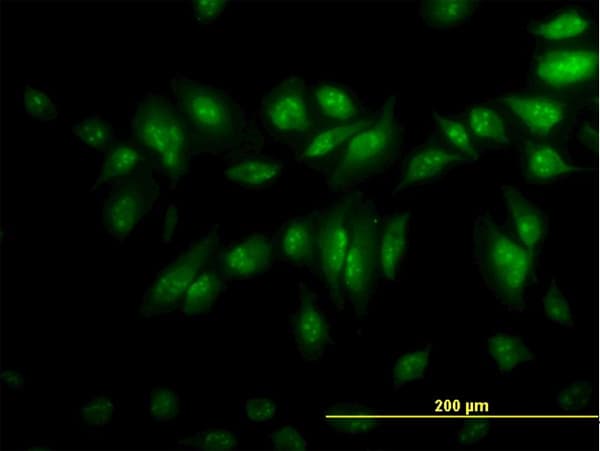 Monoclonal Mouse anti-Human CLK3 Antibody (clone 1F10, IHC, IF, WB)