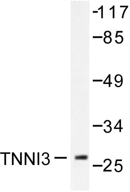 Polyclonal Rabbit anti-Human TNNI3 / Cardiac Troponin I Antibody (Gly136, IHC, IF, WB)