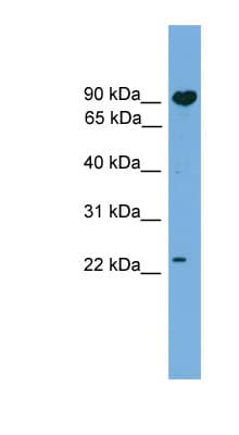 TCTEX1D4 Antibody (C-Terminus)