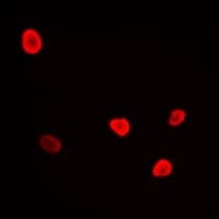 Polyclonal Rabbit anti-Human RFC4 Antibody (IHC, IF, WB)
