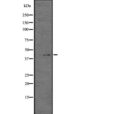 GPR21 Antibody