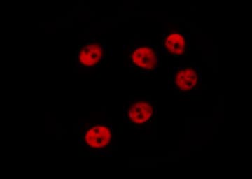 Polyclonal Rabbit anti-Human MITF Antibody (phospho-Ser180,phospho-Ser73, IHC, IF, WB)