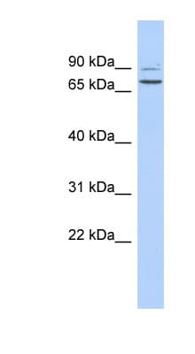 Polyclonal Rabbit anti-Human Taperin / TPRN Antibody (aa420-469, WB)