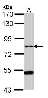 CENTG2 / AGAP1 Antibody (aa795-857)