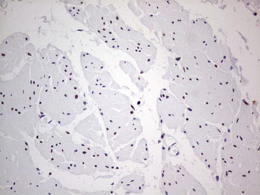 Monoclonal Mouse anti-Human C14orf166 Antibody (clone OTI4A3, IHC, WB)