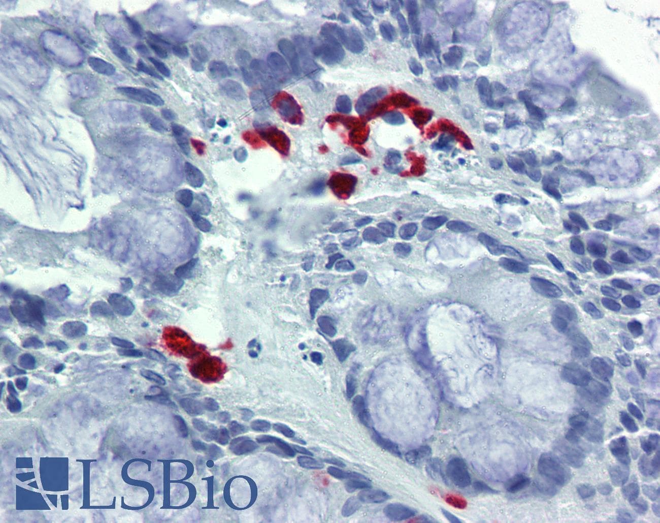 PathPlus™ FASLG / Fas Ligand Antibody