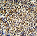 Polyclonal Rabbit anti-Human KIR2DL5B Antibody (aa264-290, IHC, WB)