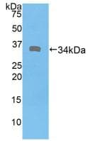 DMD / Dystrophin Antibody (aa3048-3328, FITC)