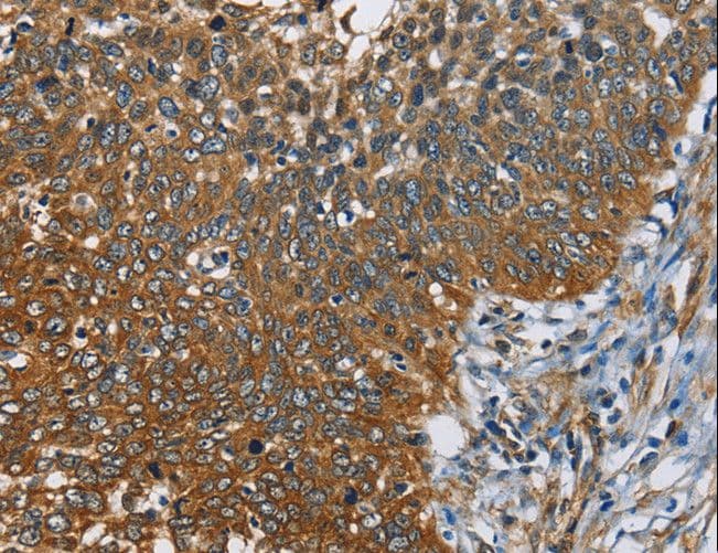 Polyclonal Rabbit anti-Human CAST / Calpastatin Antibody (IHC, WB)