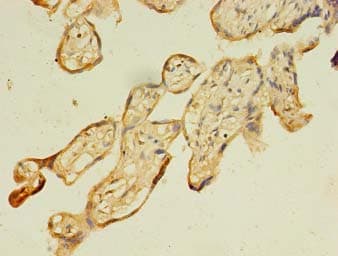 Polyclonal Rabbit anti-Human FAD104 / FNDC3B Antibody (IHC)
