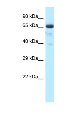 BTRCP / BETA-TRCP Antibody (aa49-98)