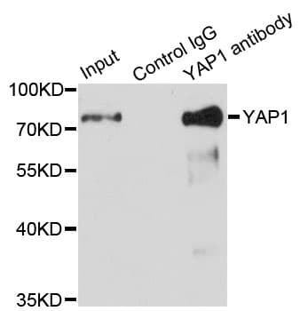 YAP / YAP1 Antibody