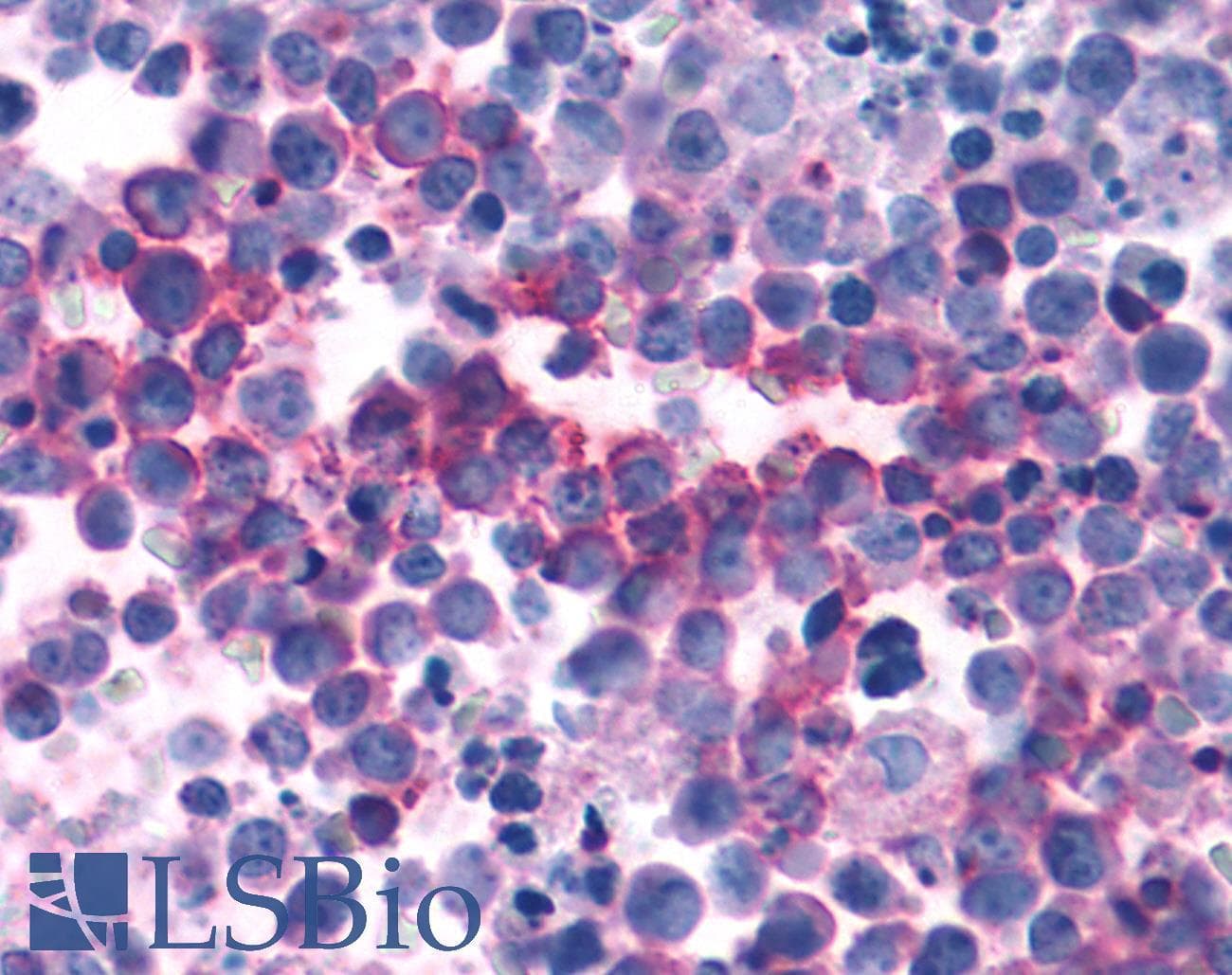 PathPlus™ PKD3 / PRKD3 Antibody (Internal)