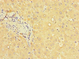 PCBD1 / PHS Antibody