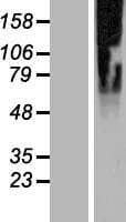 SLC35G2 Protein (Over-Expression Lysate Myc-DDK (Flag))