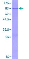 Human ARSG / Arylsulfatase G Protein (Recombinant GST)