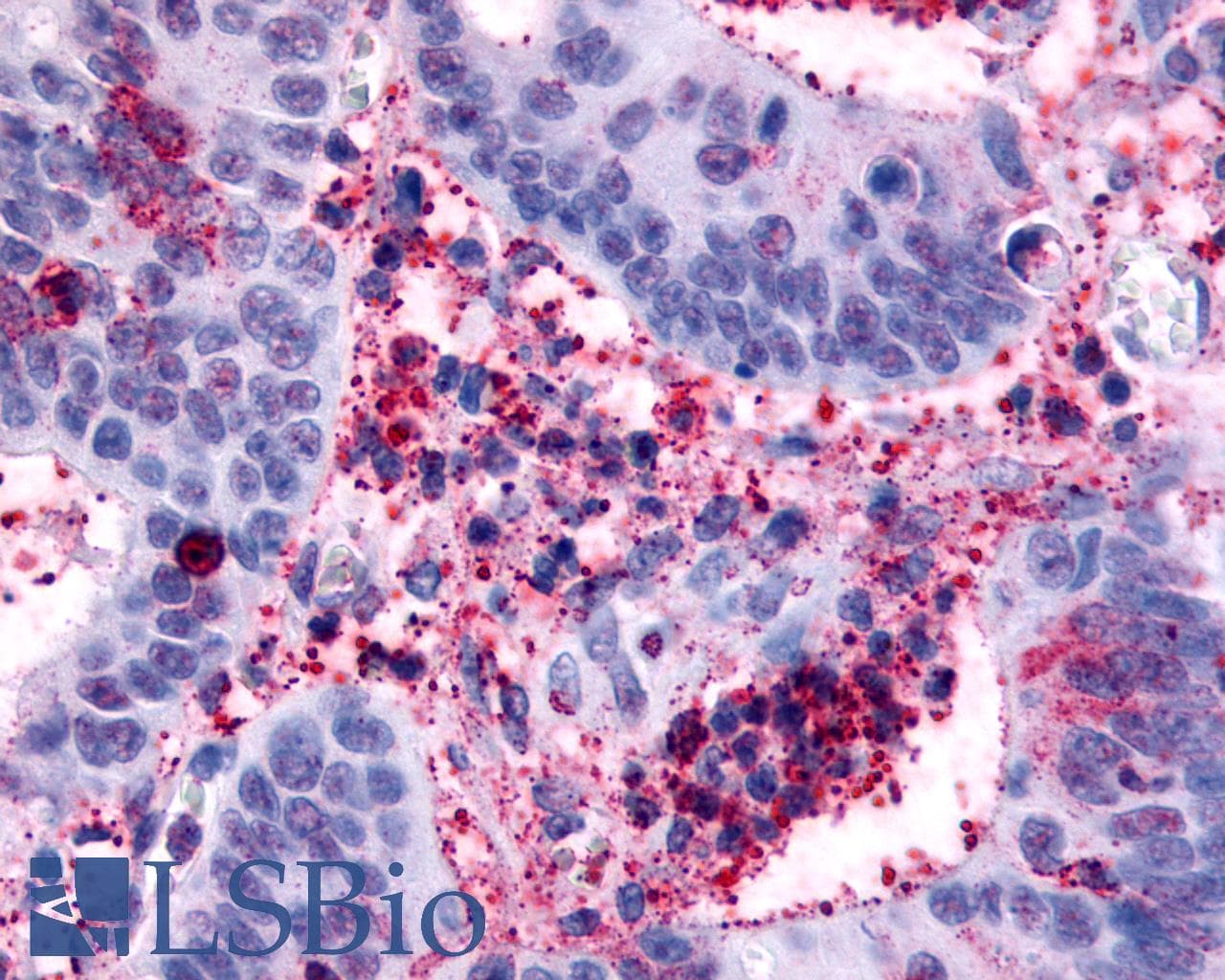 PathPlus™ HRH4 / Histamine H4 Receptor Antibody (Cytoplasmic Domain)