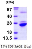 Human Gpnat1 / GNPNAT1 Protein (Recombinant His)
