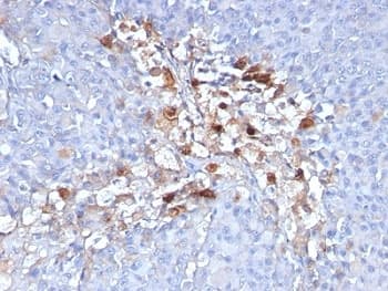 MCAM / CD146 Antibody (clone C146/634)