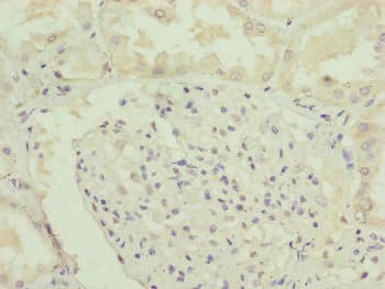 RNF135 Antibody
