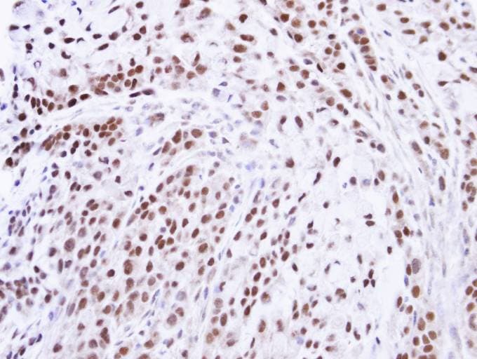 ZNF346 Antibody (aa1-294)