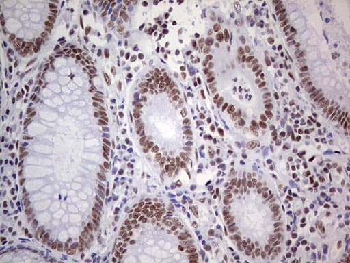 PPP1R8 / Rnase E Antibody (aa1-225, clone OTI5H9)