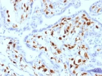 F13A1 / Factor XIIIa Antibody (clone SPM180, Azide-free, BSA-free)