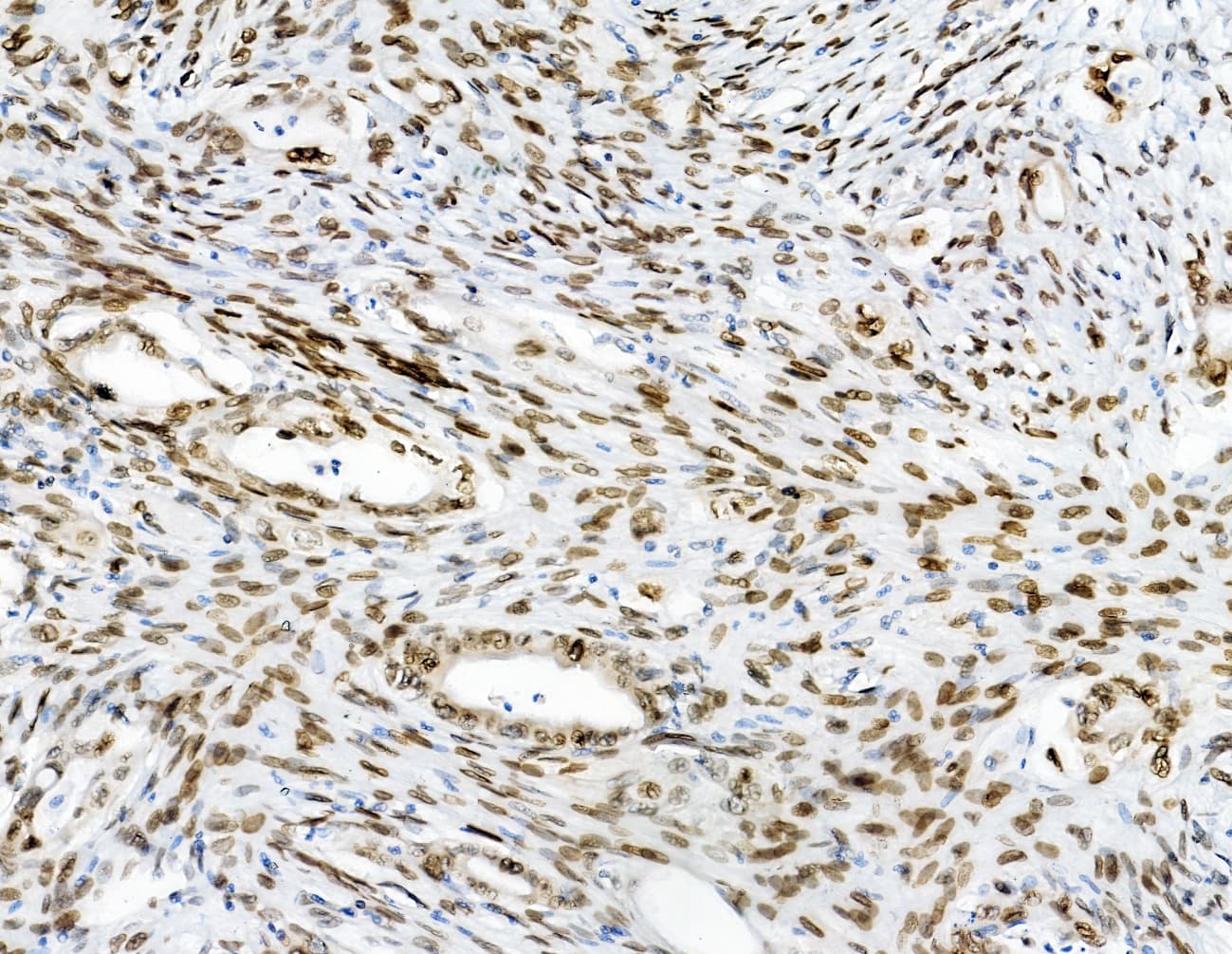 Polyclonal Rabbit anti-Human EMD / Emerin Antibody (IHC, WB)