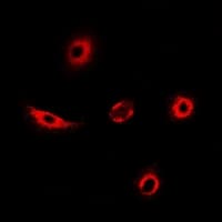 TAGLN2 / Transgelin 2 Antibody