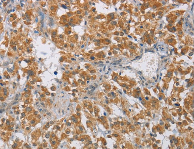 DIO1 / TXDI1 Antibody