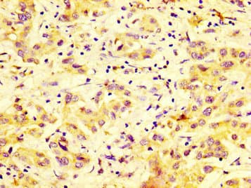 DUSP9 Antibody