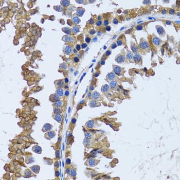 Polyclonal Rabbit anti-Human IMPA1 / IMP Antibody (IHC, IF, WB)