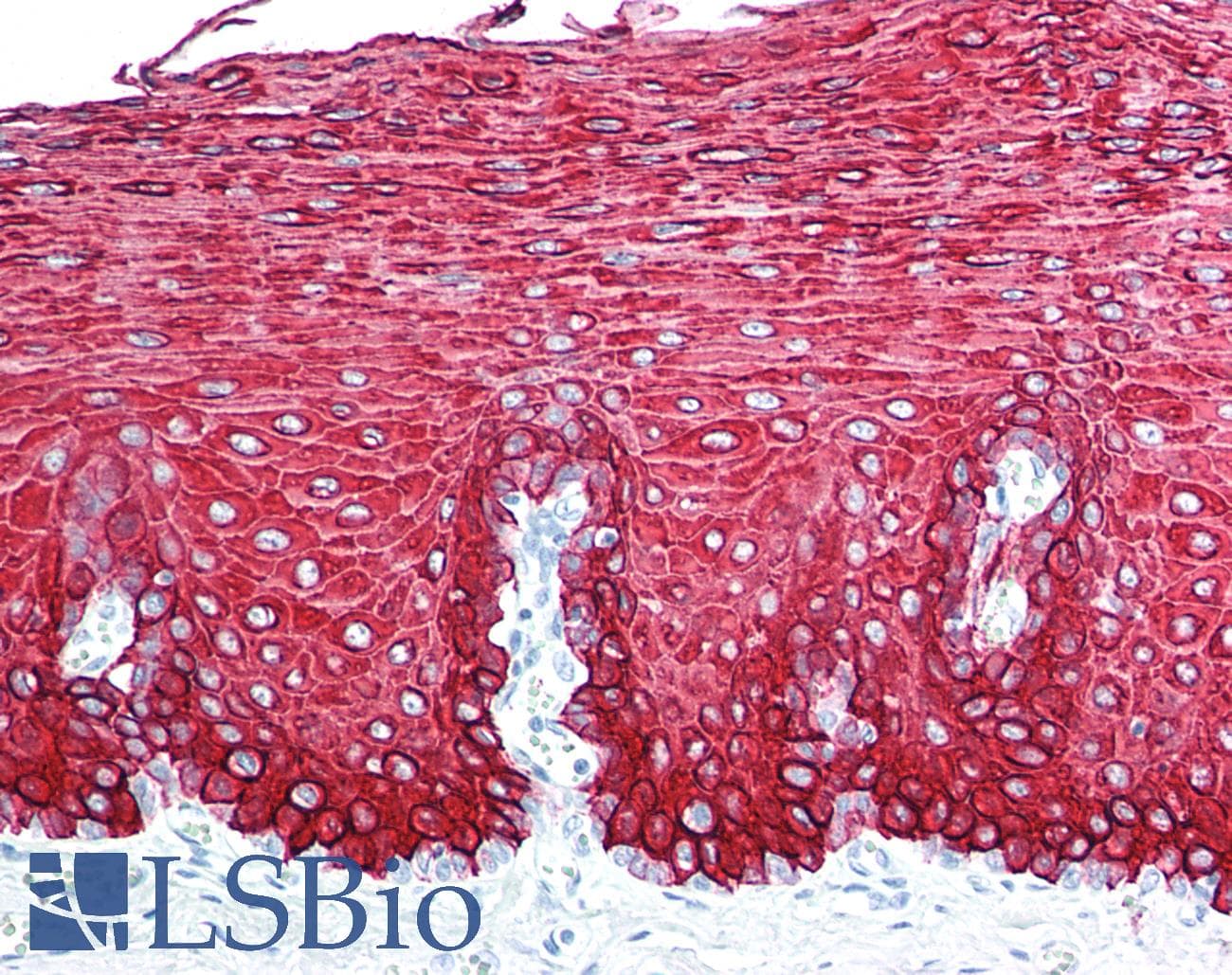PathPlus™ KRT13 / CK13 / Cytokeratin 13 Antibody